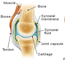Arthritic Joints