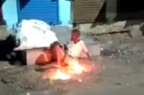 Chennai: Drunk men attack homeless man, set his private parts on fire