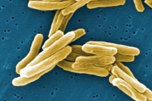 Drug-resistant TB cases may spike in India by 2040