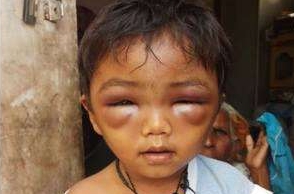 Crul tuition teacher beats up 3-year-old boy brutally
