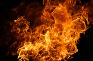 Woman set on fire for dowry by husband