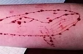 College student commits suicide, Blue Whale symbol found on his hand