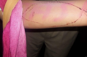 17-year-old jumps into lake, had ‘Blue Whale’ carved in arm