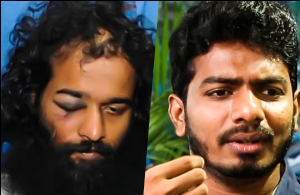 IIT Madras Beef Fest!:Reason Behind Suraj's attack and Protests|IIT student speaks the facts!RK21