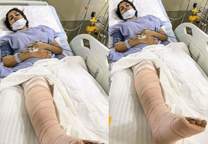 Yashika Hospital photo leaked leg fracture health recovering 