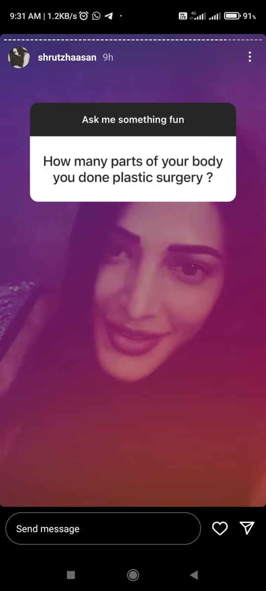 actress shruthi haasan talks about plastic surgery