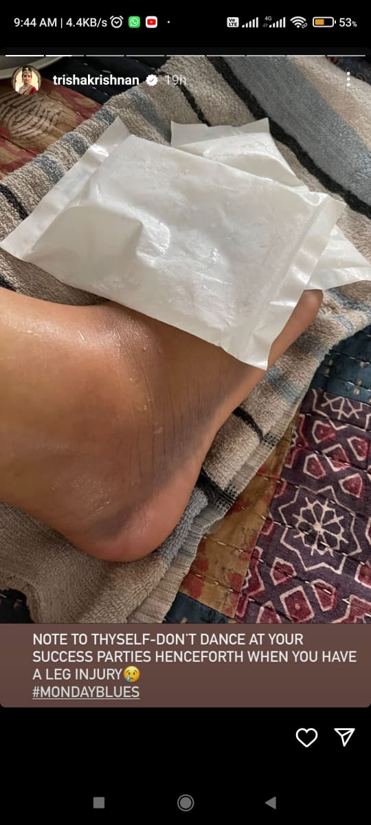 Ponniyin Selvan Trisha Krishnan Shared Her Toe Swelling Photo 