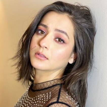 Anarkkali actress Priyal Gor posted a photo with scar on Face