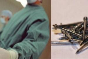 116 iron nails, wire, pellet removed from man's stomach - too hard to digest