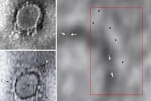 First Images from India of Virus Causing Covid-19 Captured by Scientists!