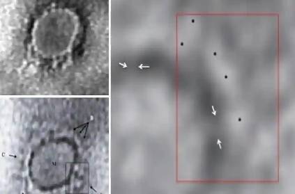 First Images from India of Virus Causing Covid-19 Captured
