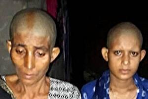 Mother, Newlywed Daughter Thrashed, Head Shaved for This Shocking Reason