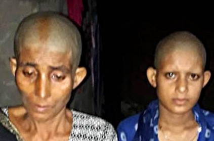 Two women assaulted, tonsured for resisting rape bid by councillor in