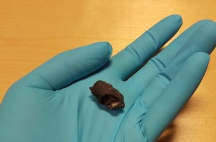 DNA found in 10000 year old chewing gum