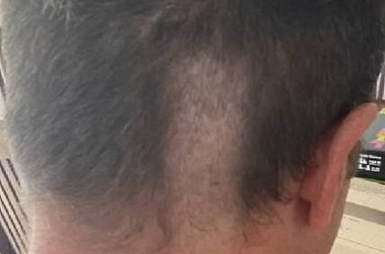 england cricketer post pic of disastrous haircut, wife apologises