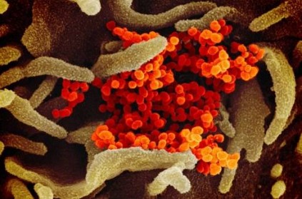 Coronavirus Microscope Images Published by U.S. Researchers 