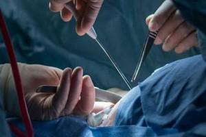 Doctors Remove Whole Dead Fish From Man's Rectum; Reveals How It Entered - Report!