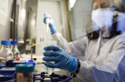 israel claims to develop covid19 antibody for coronavirus patient