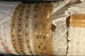 Man who eats this famous food everyday found 5 feet long tapeworm in his poop