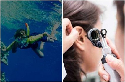 Crab gets stuck in woman\'s ear while snorkeling