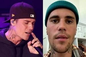 Justin Bieber says right side of his face is paralysed after this attack!