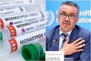 WHO outlines 5 preventive measures to stop monkeypox transmission - details!