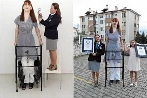 World's tallest woman alive receives 3 more Guinness World Records - details!