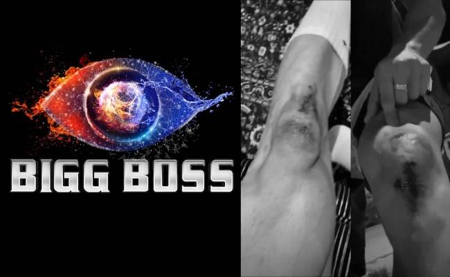 Bigg Boss star badly injured after guys on bike attacked him on the streets, shares video ft Asim Riaz