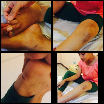 Kaajal feels sorry for Suja Varunee, who injured her leg in Bigg Boss