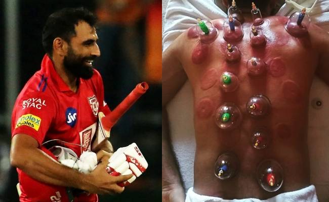 Mohammad Shami posts pic of his relaxation session