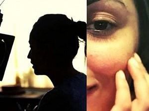 Popular heroine reveals that she's suffering from an incurable skin condition; shares unedited pics!!