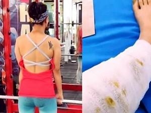 Shocking: Popular TV actress meets with an accident a day before birthday; shares video!