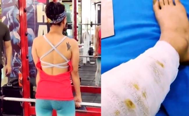 Popular TV actress meets with an accident a day before birthday, shares video ft Aanchal Khurana