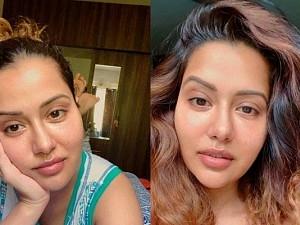 Wow! “I finally feel like myself again…” - Raiza explains how she repaired her face!