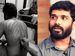 "Coin Massage nu poi..." - 'Vaazhl' hero shares what exactly happened to him!