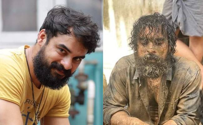 Tovino Thomas meets with accident admitted to ICU