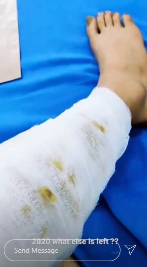 Popular TV actress meets with an accident a day before birthday, shares video ft Aanchal Khurana