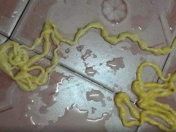 Thai man suffering from severe stomach ache pulls out tapeworm