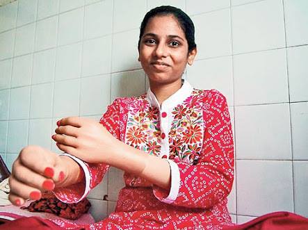 Mumbai Train Accident Victim Back Home After Hand Transplant