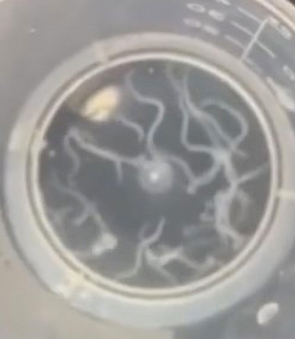 Nearly 20 live parasites have been pulled out from a Chinese man's eye