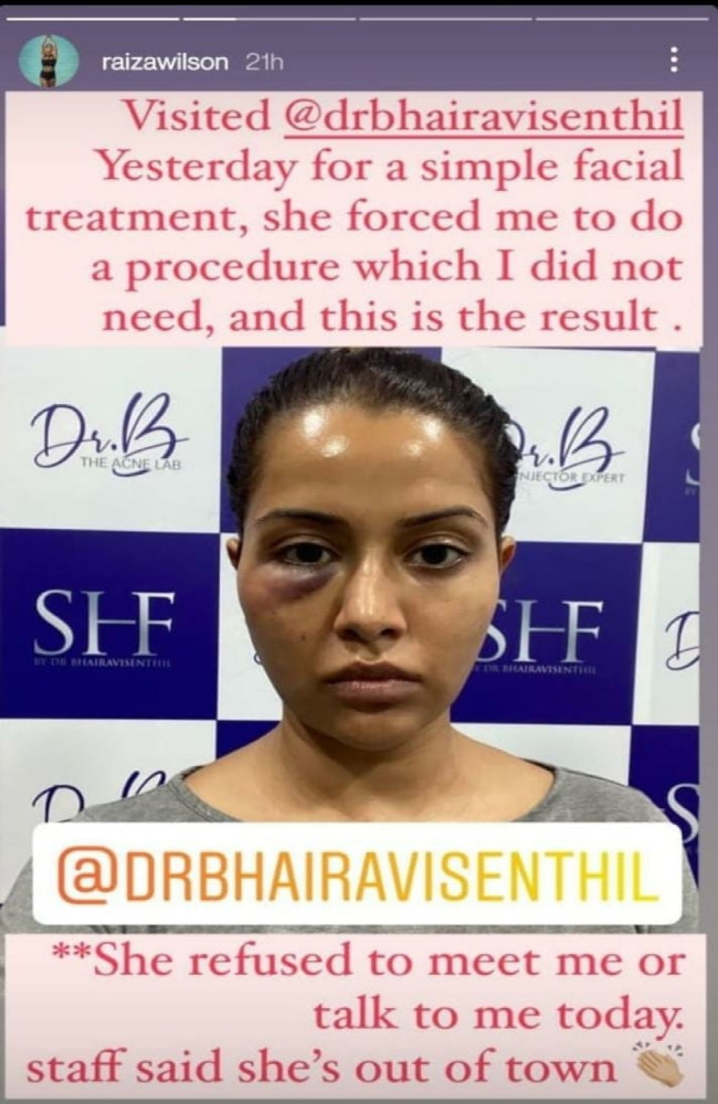Recent controversy on face treatment given to Raiza Wilson