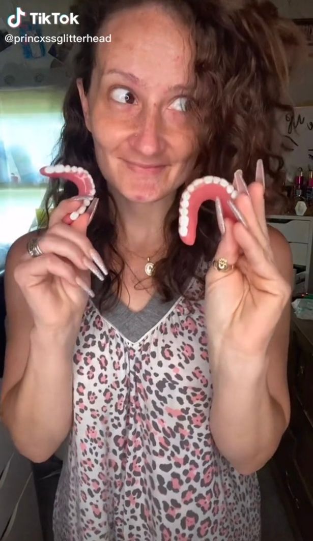 Woman whose teeth decayed during pregnancy shows off her dentures 