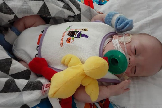 World's most premature baby celebrates first birthday 