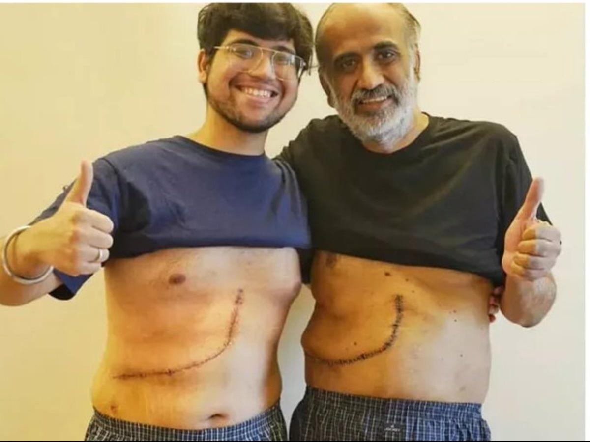 Son Gave His Father A New Life By Donating 65 Percent Of His Liver