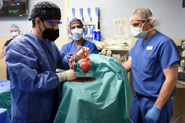 Ameriacan man who got first pig heart dies 2 months after operation
