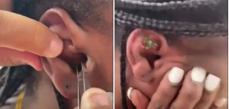 Crab Gets Stuck In Woman Ear While Snorkelling