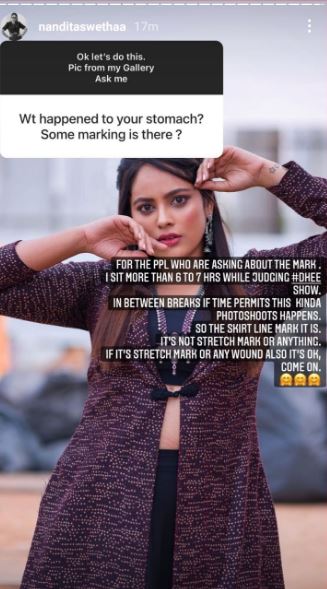 Nandita swetha reply to fans question about her stomach