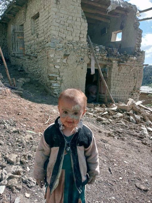 Afghanistan earthquake Picture of a little survivor goes viral