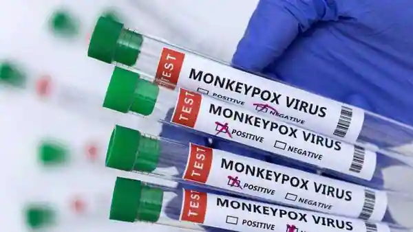 Thailand First Monkeypox Patient Found after Fleeing to Cambodia