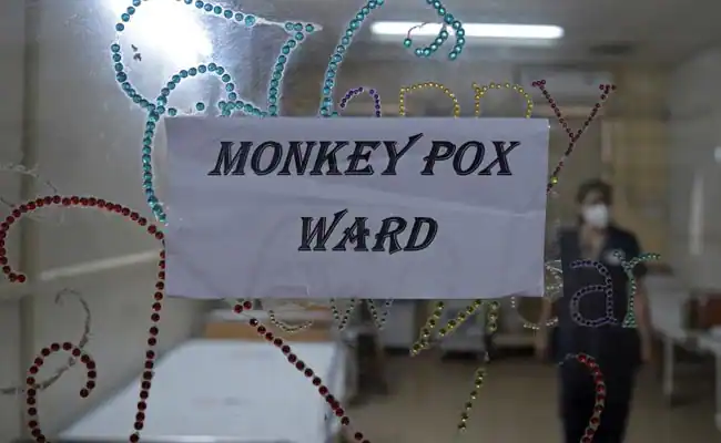 Monkeypox scare Health Ministry shares dos and donts